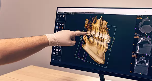 La revolución de la inteligencia artificial en el diagnóstico dental Tac Inteligencia Artificial Inteligencia Artificial Odontología Digital Diagnóstico Dental Algoritmos Radiográficos Tratamientos Preventivos Salud Bucal Avances Tecnológicos Ia En Radiografías Detección Temprana Aprendizaje Automático Precisión Diagnóstica Teleodontología Diagnóstico Digital Estética Dental Prevención Dental Tratamientos Personalizados Radiografías Digitales Futuro Odontológico Consultas Virtuales Cuidado Dental Innovaciones Dentales Biomateriales Dentales Caries Y Ia Periodontitis Odontología Holística Impacto De La Ia Evolución Tecnológica Diagnóstico Eficiente Teledentistry Estrategias Preventivas Anomalías Estructurales Imágenes Radiográficas Datos Del Paciente Odontología